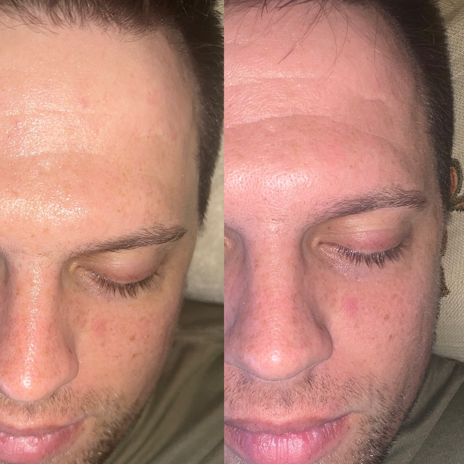 Antes y Después Oxygeo